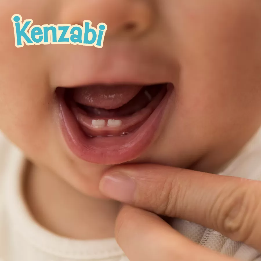 Con gần 1 tuổi chưa mọc răng – mẹ nên hiểu đúng để bớt căng thẳng